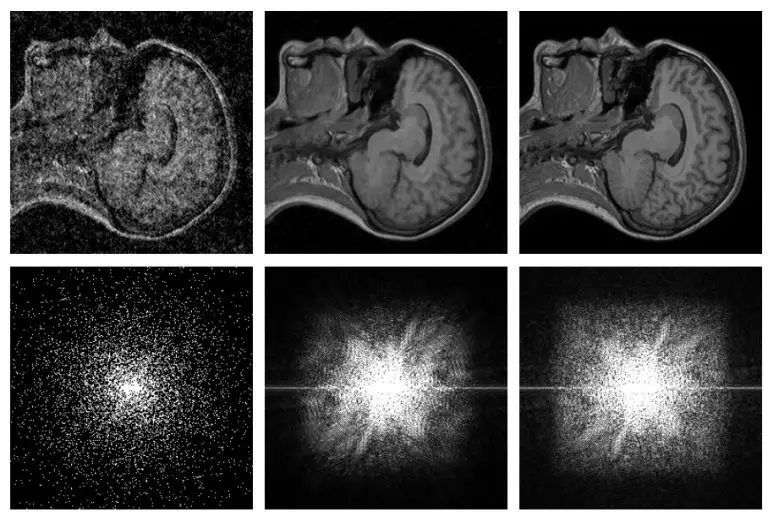 artificial intelligence image noise