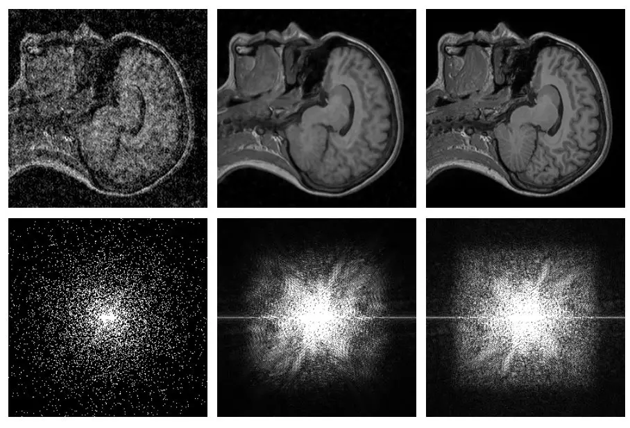 artificial intelligence image noise